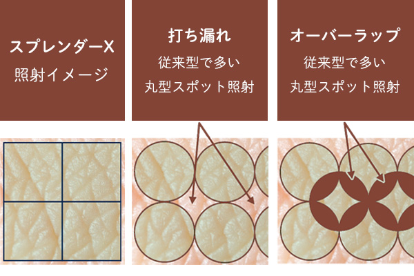 スプレンダーX照射イメージ