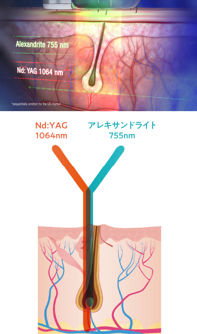 2種類の波長イメージ